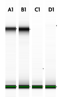 TapeStation analysis of Nuclear RNA before and after DNase I treatment
